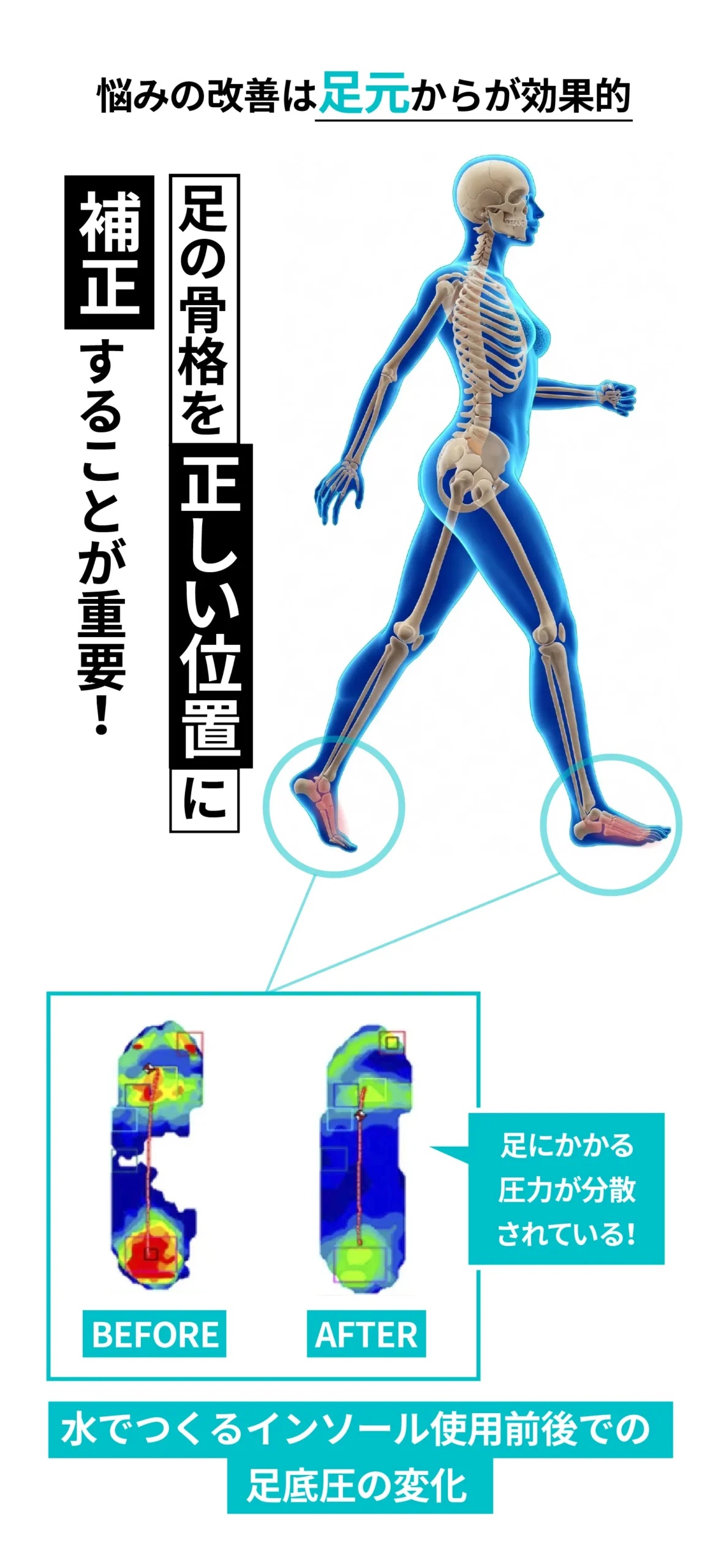 水でつくるインソール使用前後の足圧比較。足の骨格を正しい位置に補正し、足元から姿勢改善をサポート
