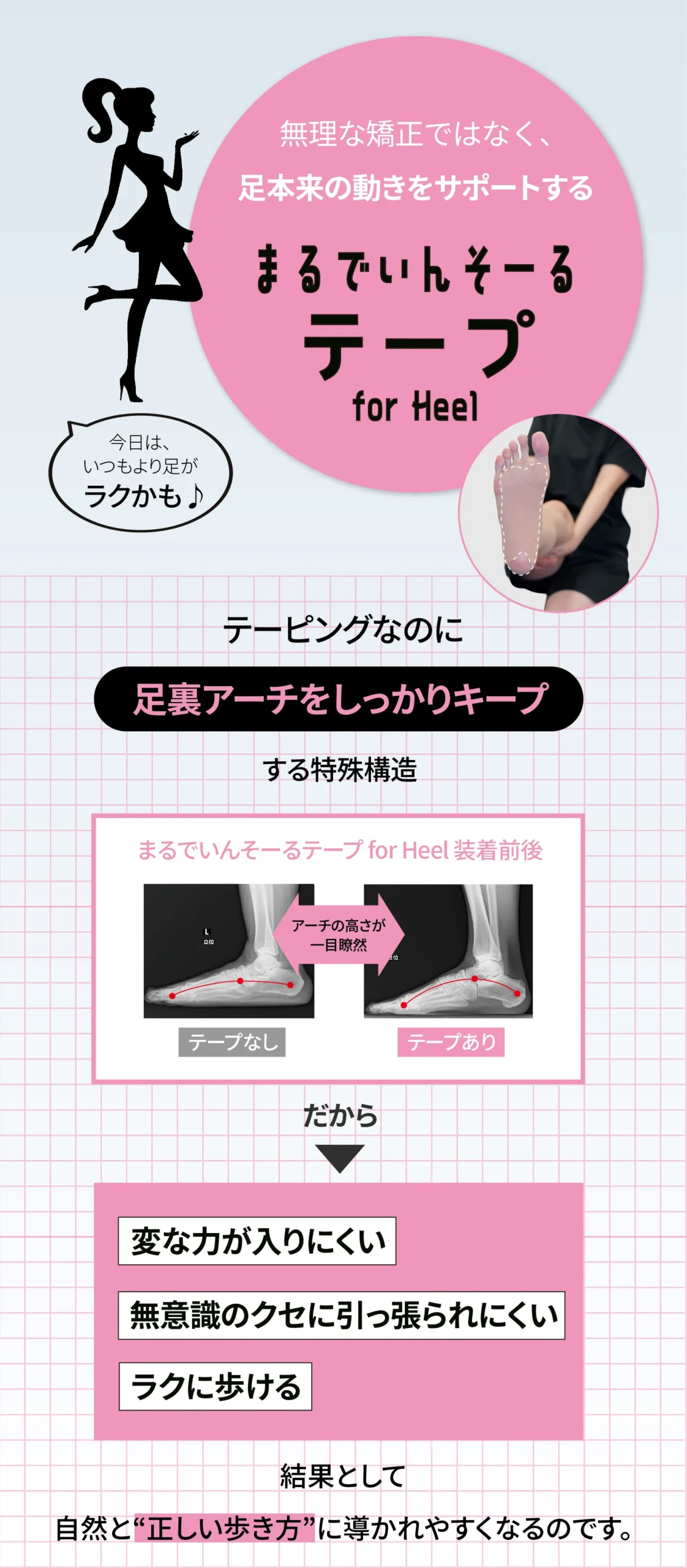 アーチ崩れが全身のバランスにも影響することの説明